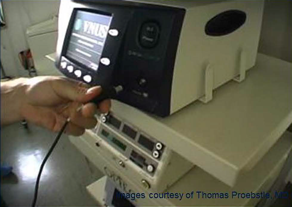 Процедура посегментной РЧА _ подготовка к процедуре _ 1.png