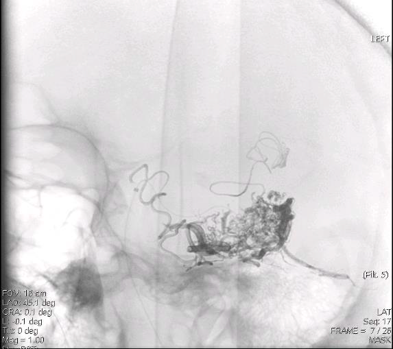 Мед.цианоакрилат и КД _ клей Raabe.png