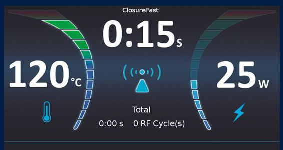 Процедура посегментной РЧА _ проведение процедуры _ 9.png